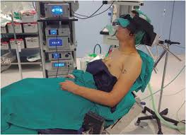 Patient in beach chair position in operation theatre for shoulder replacement surgery