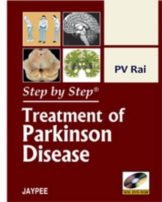 Fundamentals of Orthopedics by Mohindra